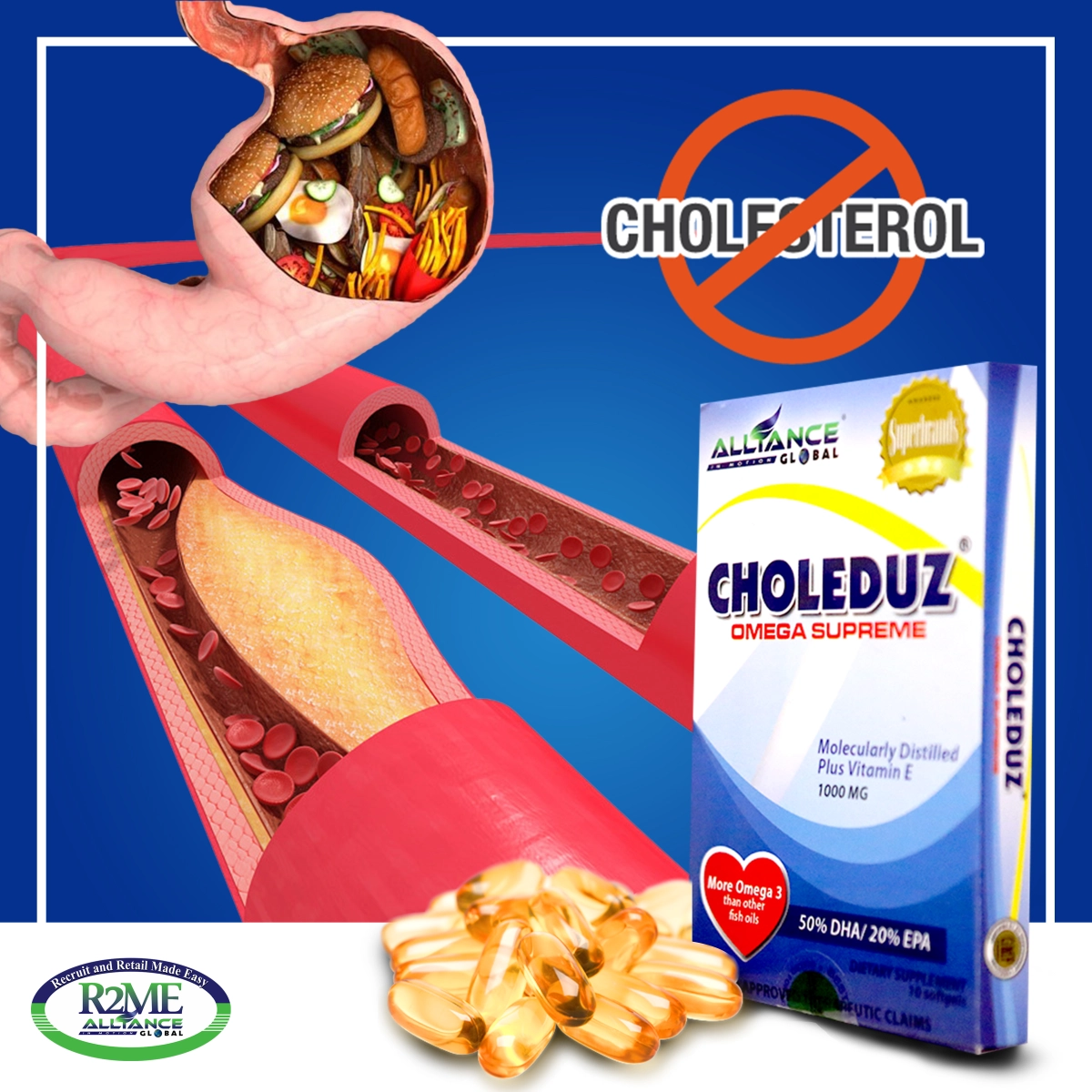 choleduz